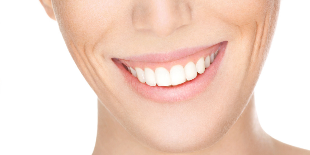 Frau mit hoher Lachlinie zum Thema "Was hilft gegen Zahnfleischentzündung?"