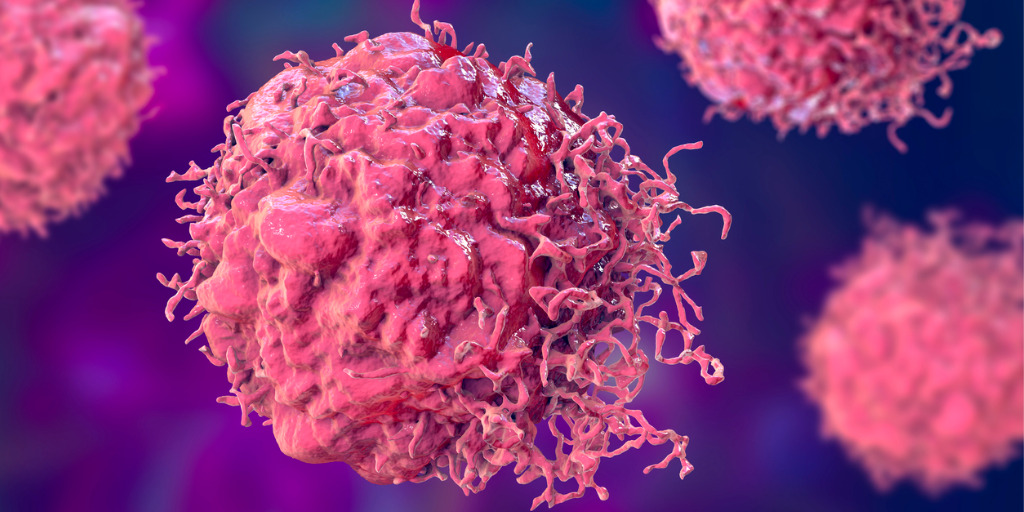 Krebszelle: Was ist Krebs?