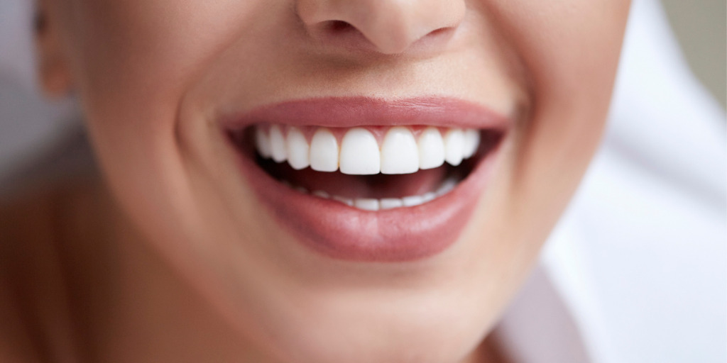 Schöne Zähne zum Thema "Was kostet eine professionelle Zahnreignigung?"