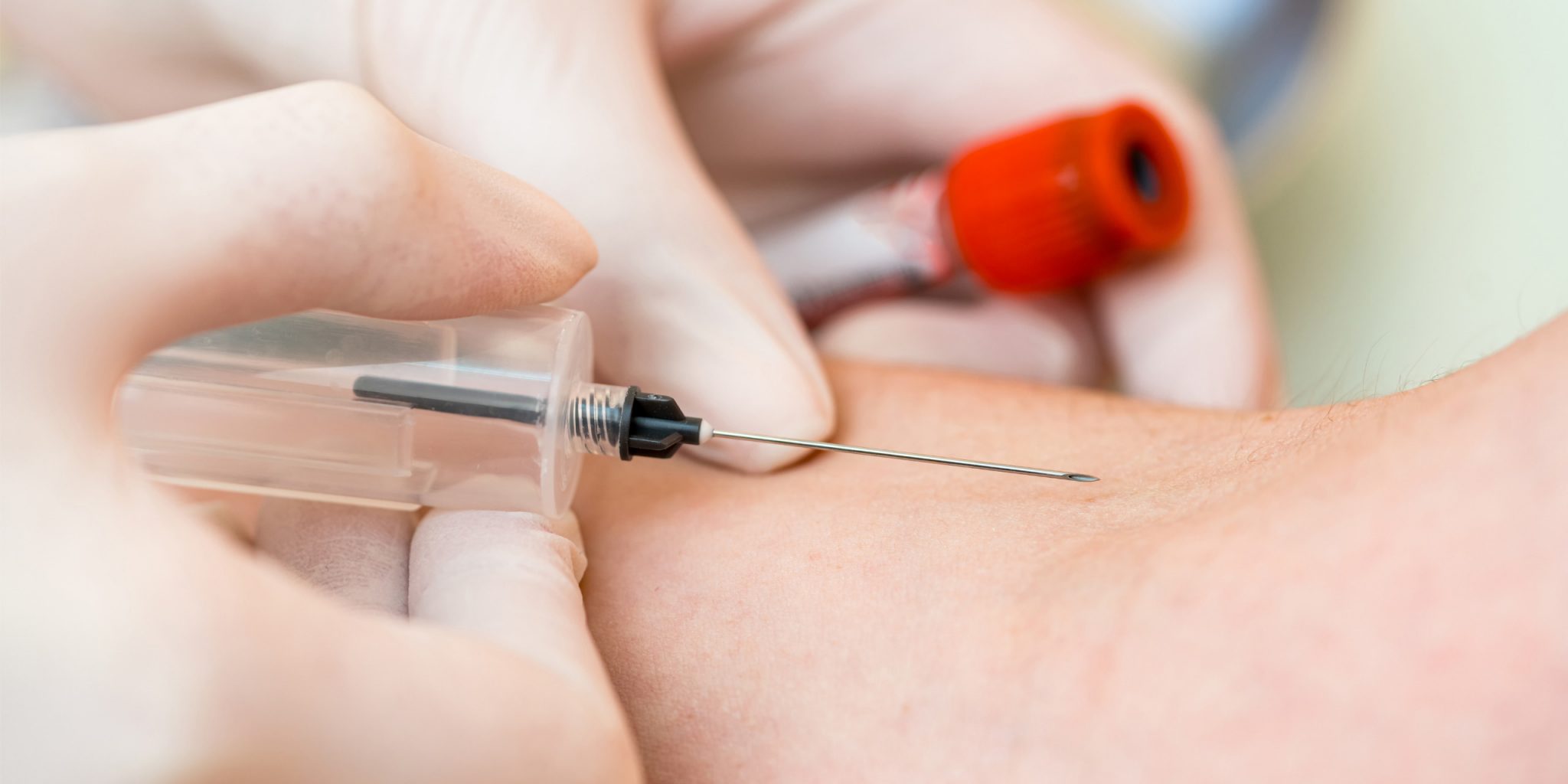Wie Lange Ist Thc Im Blut Nachweisbar 2015 mediorbis.de